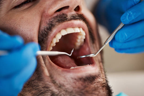 Best Emergency Dental Care for Broken or Chipped Teeth in Mountain Lodge Park, NY